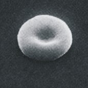 Sick Cell (for Eaton's talk)