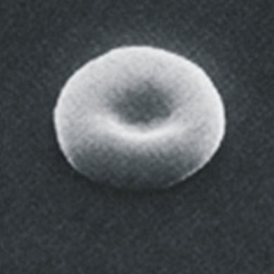 Sick Cell (for Eaton's talk)